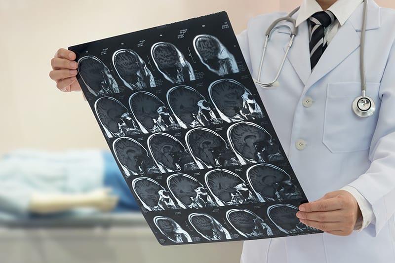 Physician holding an MRI brain scan